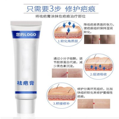 疤痕貼 修復疤痕  術(shù)后去疤 貼牌代加工